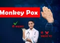 মাঙ্কি পক্স এড়াতে কী করবেন আর কী করবেন না? জানালো কেন্দ্র
